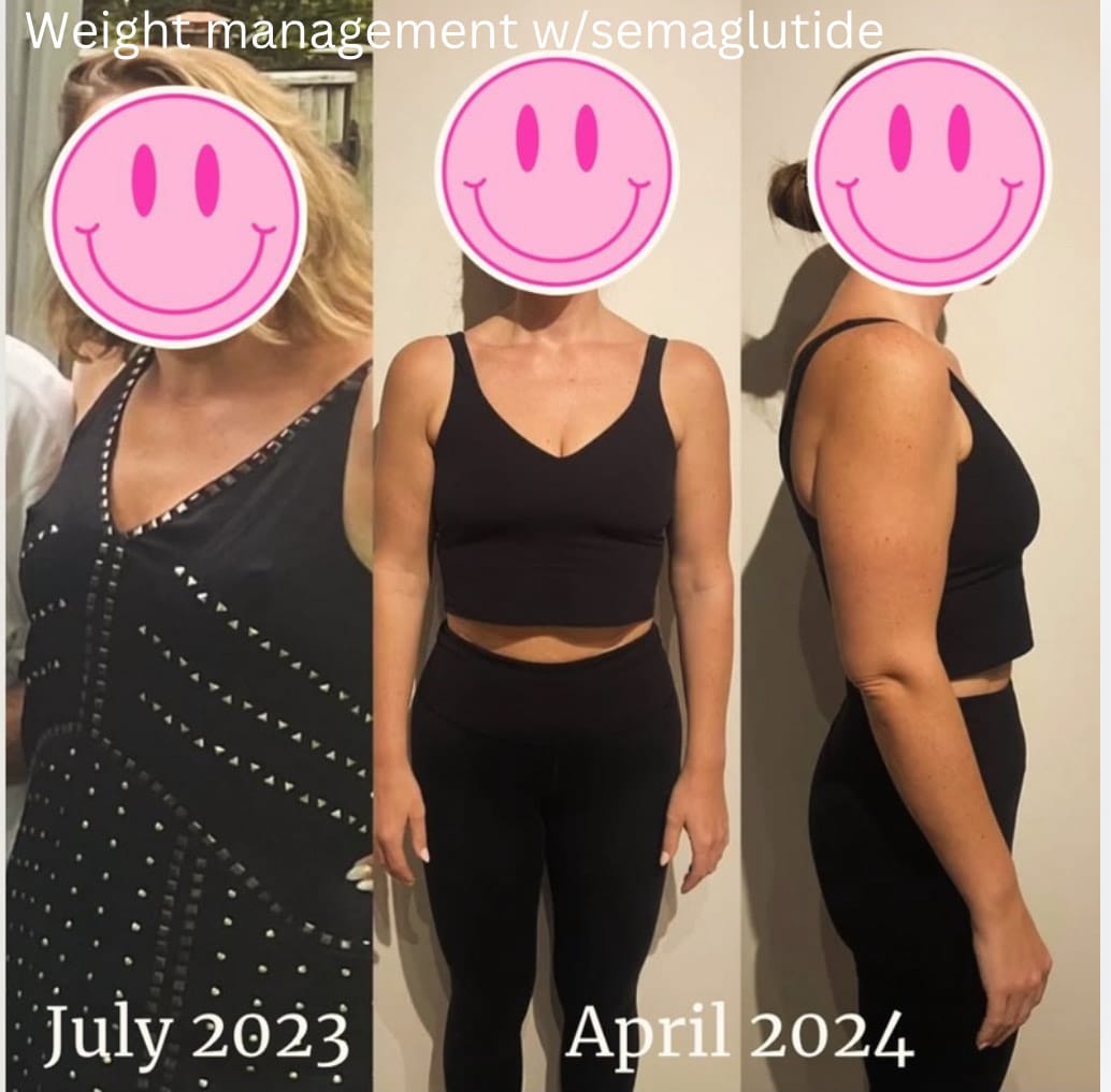 Before and After Image: Weight Loss Results - front