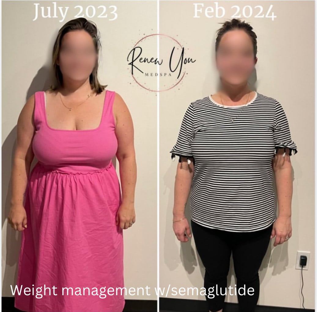 Before and After Image: Weight Loss Results - front