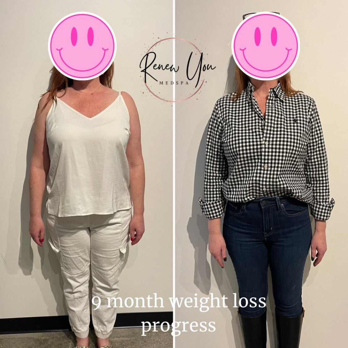 Before and After Image: Weight Loss Results - front