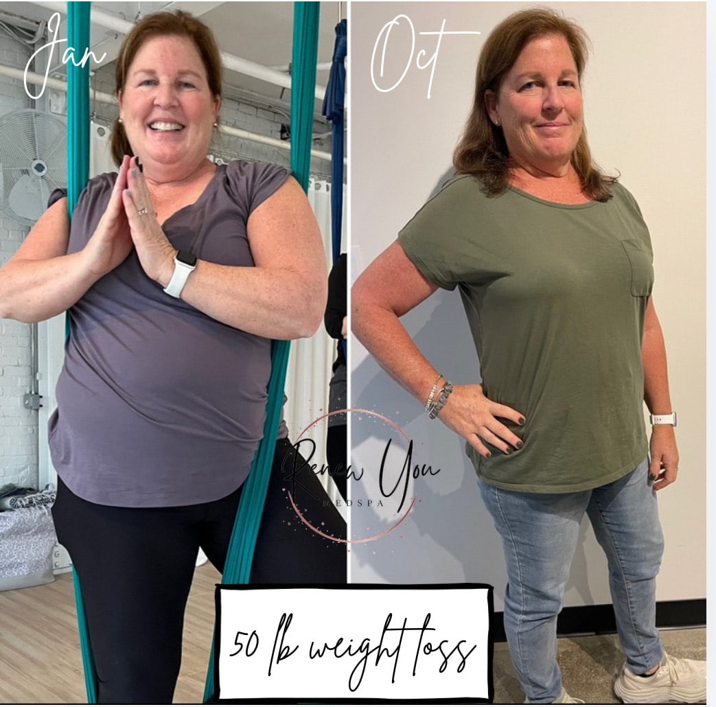 Before and After Image: Weight Loss - front